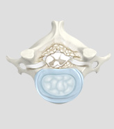 Cervical/Lumbar Stenosis