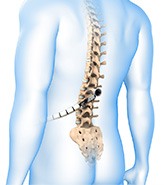 Minimally Invasive Spine Surgery