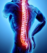 Spinal Trauma