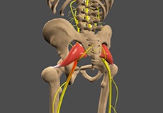 Sciatica